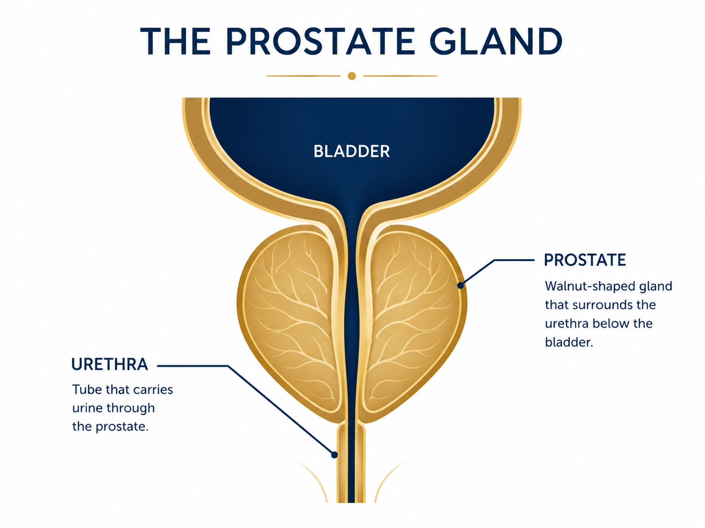 Diagram of prostate anatomy surrounding the urethra below the bladder